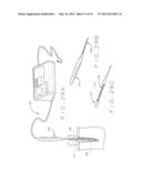 ENDODONTIC OBTURATION SYSTEM AND METHOD diagram and image