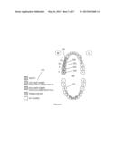 METHOD OF PROCESSING AND DISPLAYING ORAL HEALTH DIAGNOSTIC DATA diagram and image