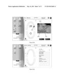 METHOD OF PROCESSING AND DISPLAYING ORAL HEALTH DIAGNOSTIC DATA diagram and image