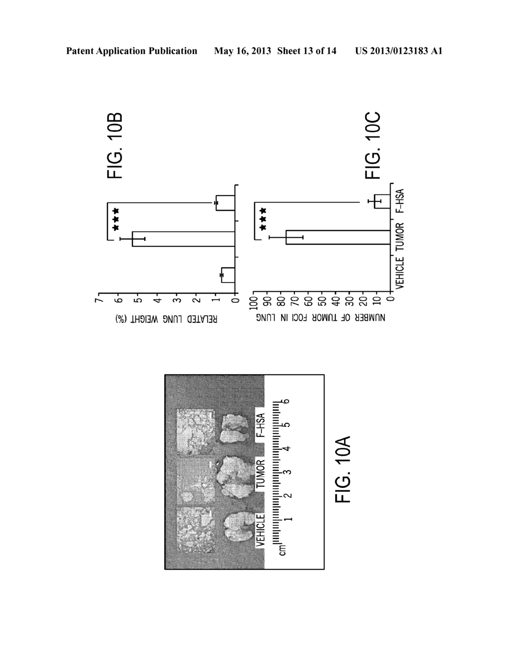 Anti-tumor Fibrillar Human Serum Albumin Methods and Compositions - diagram, schematic, and image 14