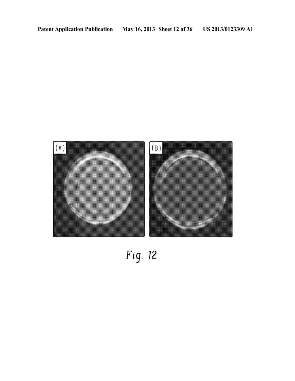 METHOD FOR REDUCING MICROBIAL LOAD FOR INDIVIDUALS WITH ELEVATED RISK     CONDITIONS - diagram, schematic, and image 13