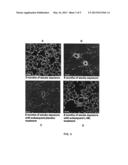 N6-(1-IMINOETHYL)-L-LYSINE FOR REGENERATION OF ALVEOLI IN LUNGS diagram and image