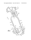 SELF-RETAINING RETRACTOR diagram and image