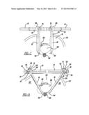 SELF-RETAINING RETRACTOR diagram and image