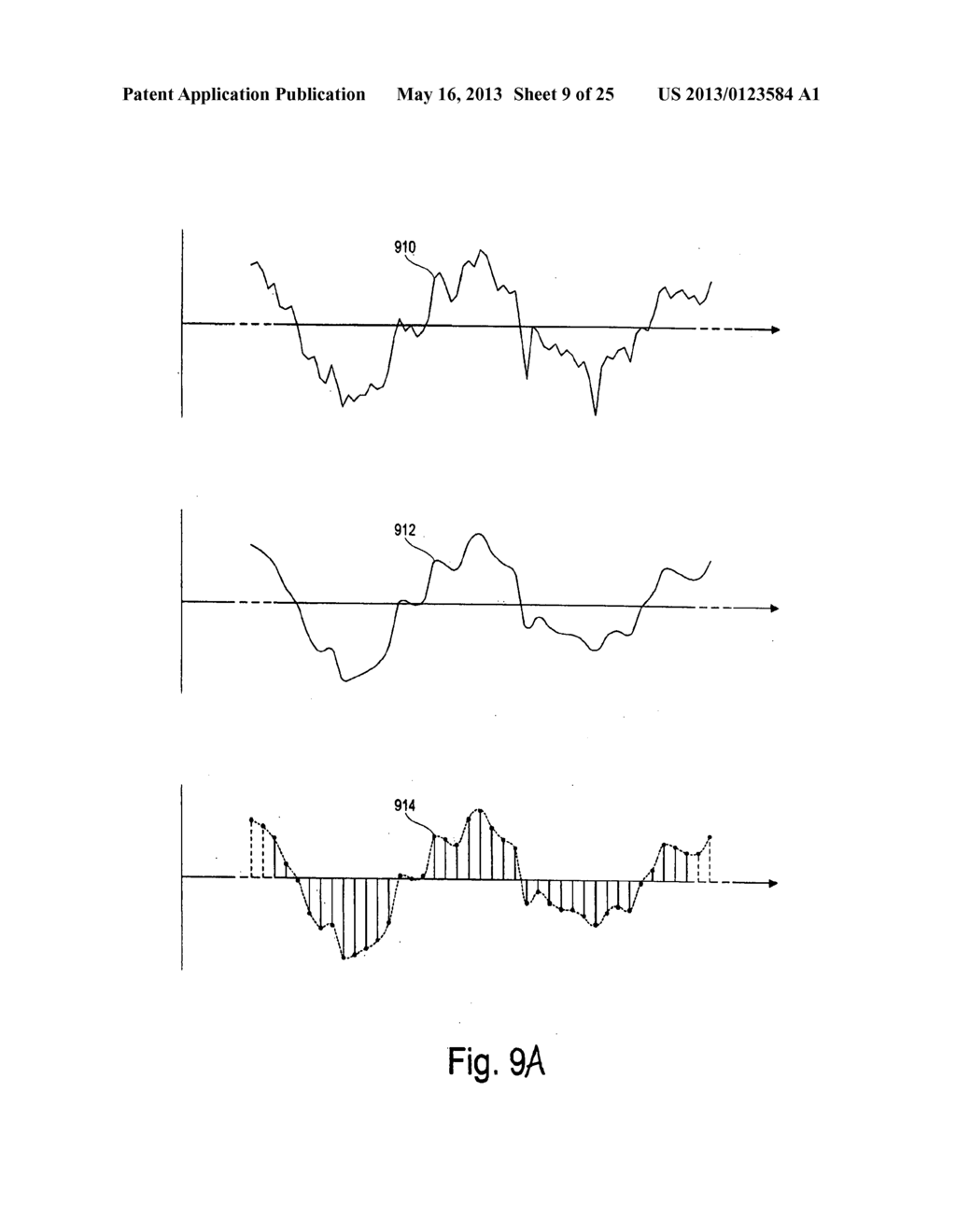 DEVICES AND METHODS FOR MONITORING PHYSIOLOGICAL INFORMATION RELATING TO     SLEEP WITH AN IMPLANTABLE DEVICE - diagram, schematic, and image 10