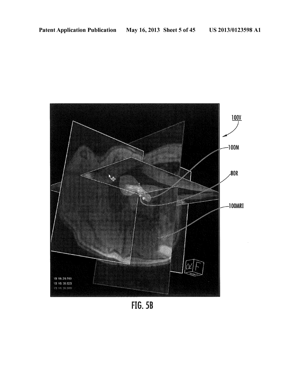 MRI-GUIDED DEVICES AND MRI-GUIDED INTERVENTIONAL SYSTEMS THAT CAN TRACK     AND GENERATE DYNAMIC VISUALIZATIONS OF THE DEVICES IN NEAR REAL TIME - diagram, schematic, and image 06