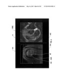 MRI-GUIDED DEVICES AND MRI-GUIDED INTERVENTIONAL SYSTEMS THAT CAN TRACK     AND GENERATE DYNAMIC VISUALIZATIONS OF THE DEVICES IN NEAR REAL TIME diagram and image