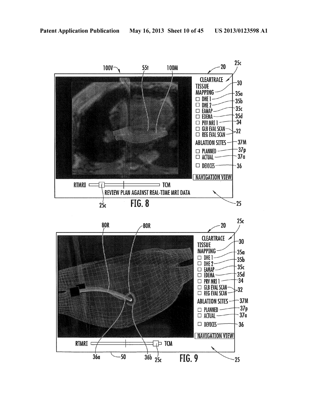 MRI-GUIDED DEVICES AND MRI-GUIDED INTERVENTIONAL SYSTEMS THAT CAN TRACK     AND GENERATE DYNAMIC VISUALIZATIONS OF THE DEVICES IN NEAR REAL TIME - diagram, schematic, and image 11