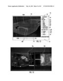 MRI-GUIDED DEVICES AND MRI-GUIDED INTERVENTIONAL SYSTEMS THAT CAN TRACK     AND GENERATE DYNAMIC VISUALIZATIONS OF THE DEVICES IN NEAR REAL TIME diagram and image