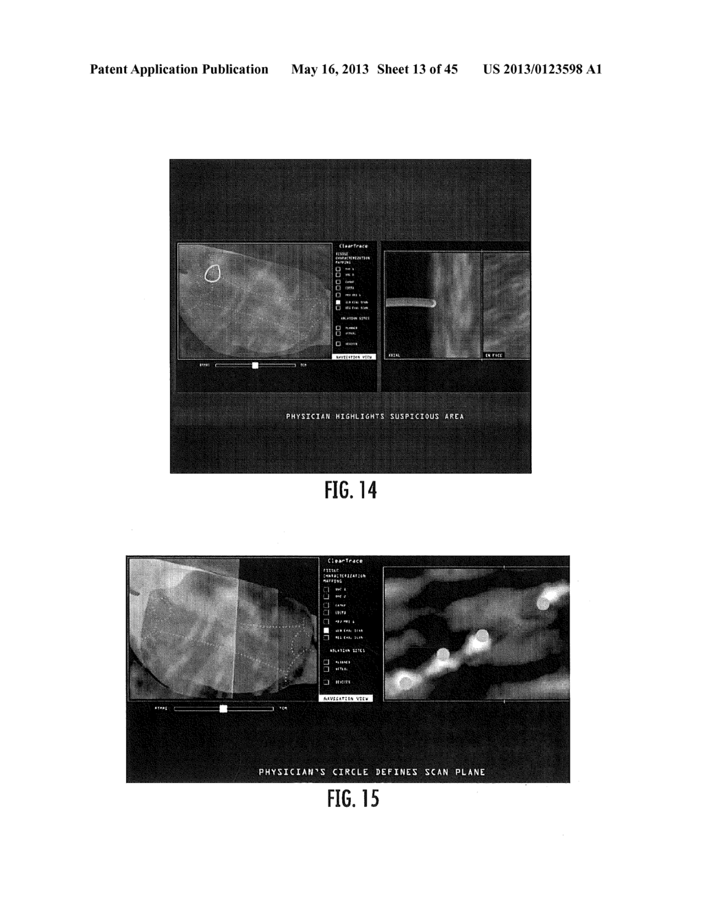 MRI-GUIDED DEVICES AND MRI-GUIDED INTERVENTIONAL SYSTEMS THAT CAN TRACK     AND GENERATE DYNAMIC VISUALIZATIONS OF THE DEVICES IN NEAR REAL TIME - diagram, schematic, and image 14