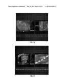 MRI-GUIDED DEVICES AND MRI-GUIDED INTERVENTIONAL SYSTEMS THAT CAN TRACK     AND GENERATE DYNAMIC VISUALIZATIONS OF THE DEVICES IN NEAR REAL TIME diagram and image
