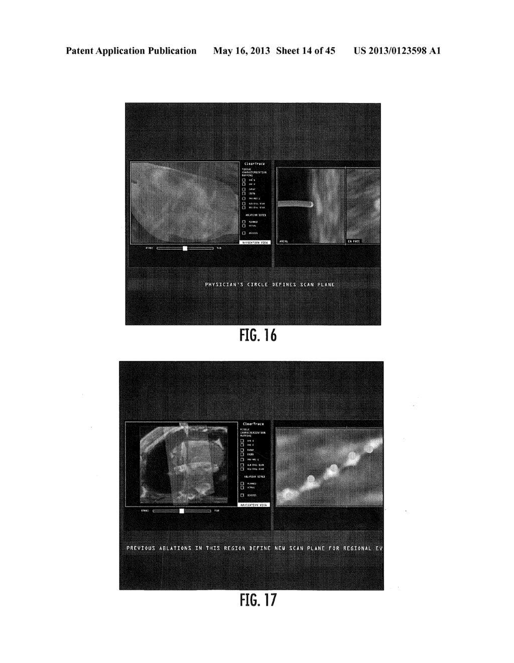 MRI-GUIDED DEVICES AND MRI-GUIDED INTERVENTIONAL SYSTEMS THAT CAN TRACK     AND GENERATE DYNAMIC VISUALIZATIONS OF THE DEVICES IN NEAR REAL TIME - diagram, schematic, and image 15