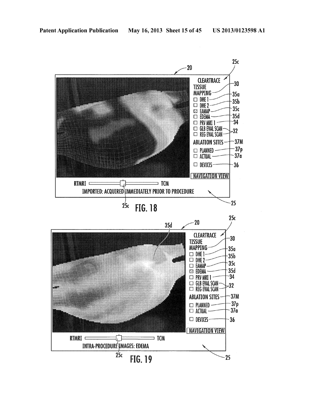 MRI-GUIDED DEVICES AND MRI-GUIDED INTERVENTIONAL SYSTEMS THAT CAN TRACK     AND GENERATE DYNAMIC VISUALIZATIONS OF THE DEVICES IN NEAR REAL TIME - diagram, schematic, and image 16