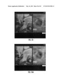 MRI-GUIDED DEVICES AND MRI-GUIDED INTERVENTIONAL SYSTEMS THAT CAN TRACK     AND GENERATE DYNAMIC VISUALIZATIONS OF THE DEVICES IN NEAR REAL TIME diagram and image