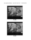 MRI-GUIDED DEVICES AND MRI-GUIDED INTERVENTIONAL SYSTEMS THAT CAN TRACK     AND GENERATE DYNAMIC VISUALIZATIONS OF THE DEVICES IN NEAR REAL TIME diagram and image