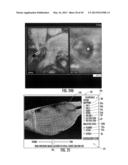 MRI-GUIDED DEVICES AND MRI-GUIDED INTERVENTIONAL SYSTEMS THAT CAN TRACK     AND GENERATE DYNAMIC VISUALIZATIONS OF THE DEVICES IN NEAR REAL TIME diagram and image