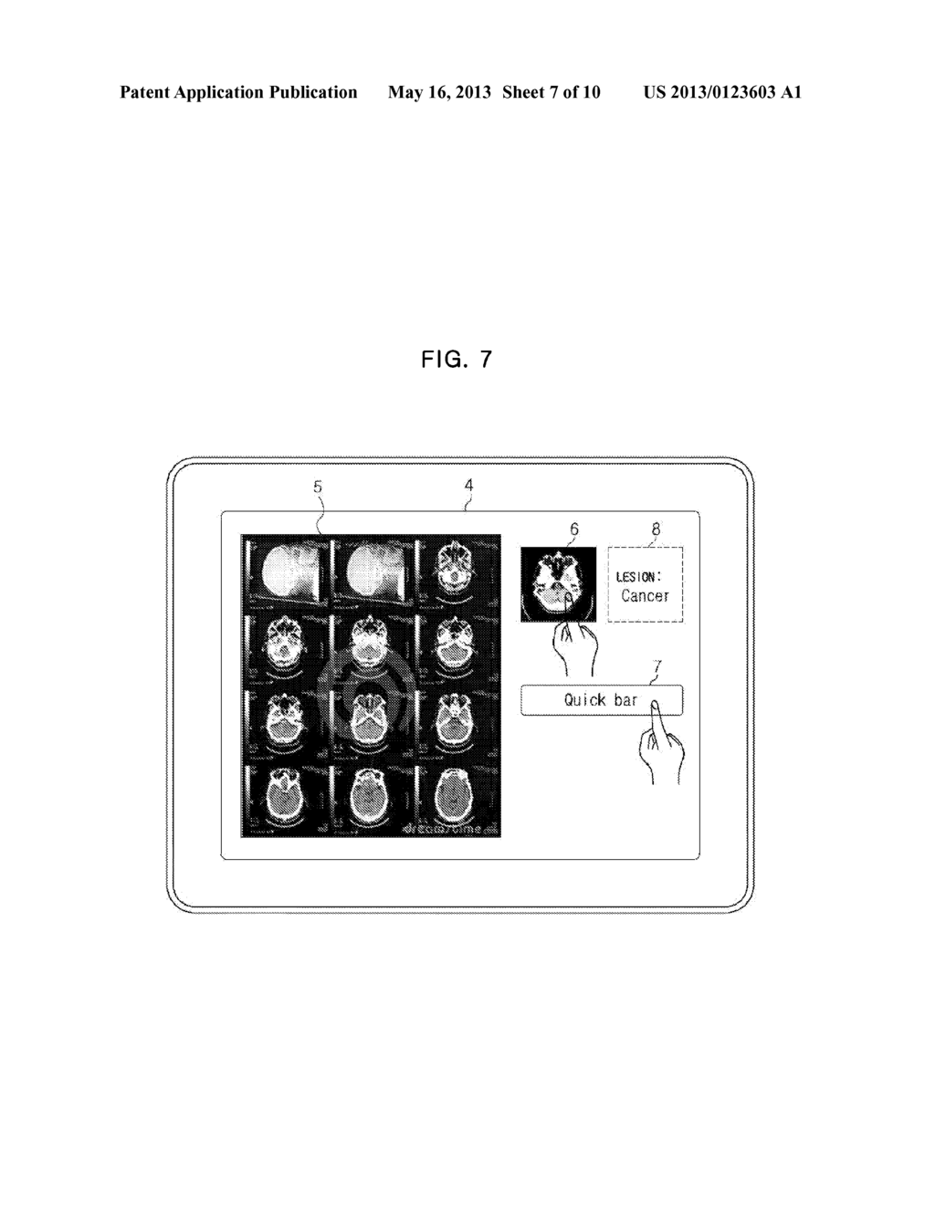 MEDICAL DEVICE AND METHOD FOR DISPLAYING MEDICAL IMAGE USING THE SAME - diagram, schematic, and image 08