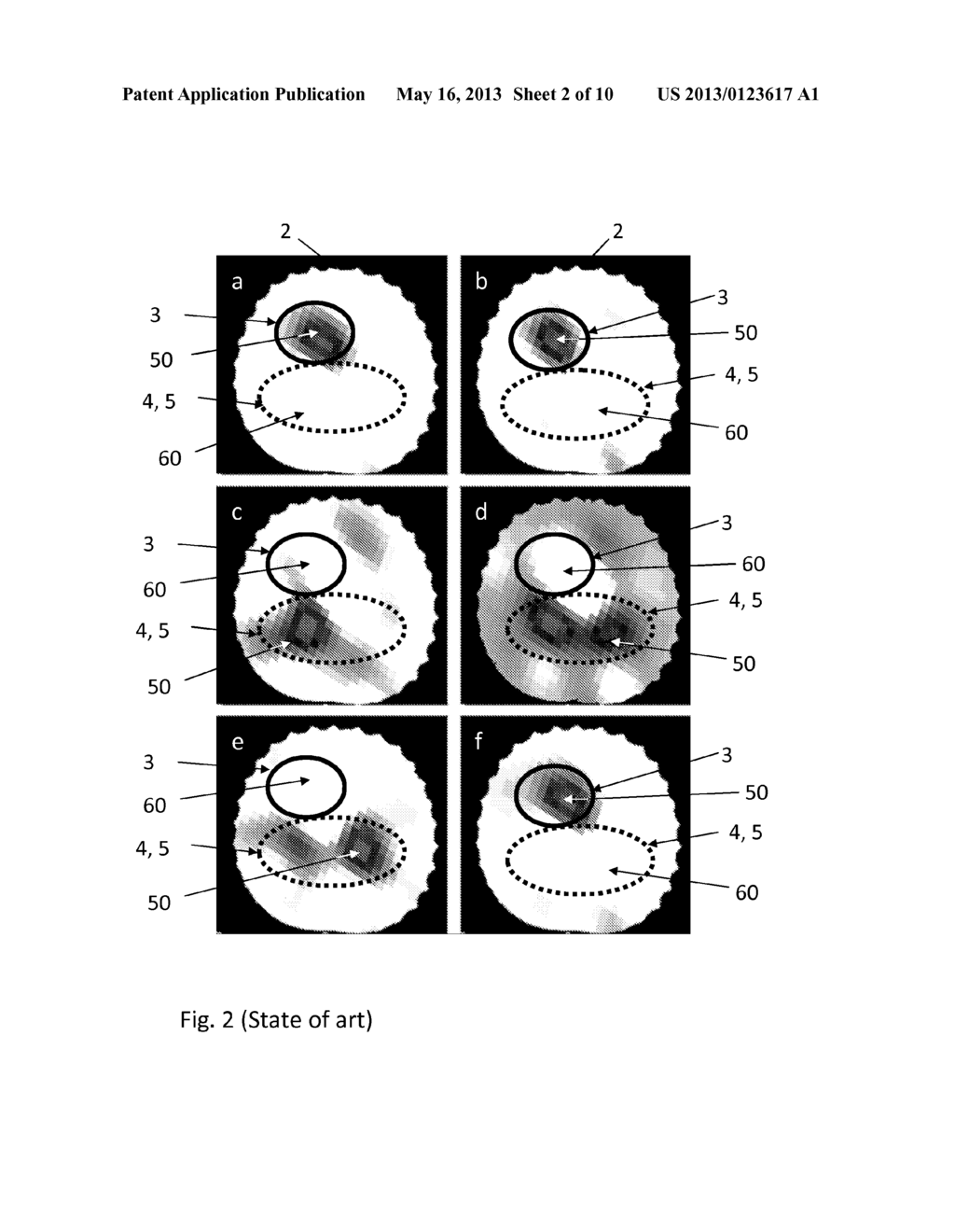 Method and Apparatus for the Non-Invasive Measurement of Pulse Transit     Times (PTT) - diagram, schematic, and image 03