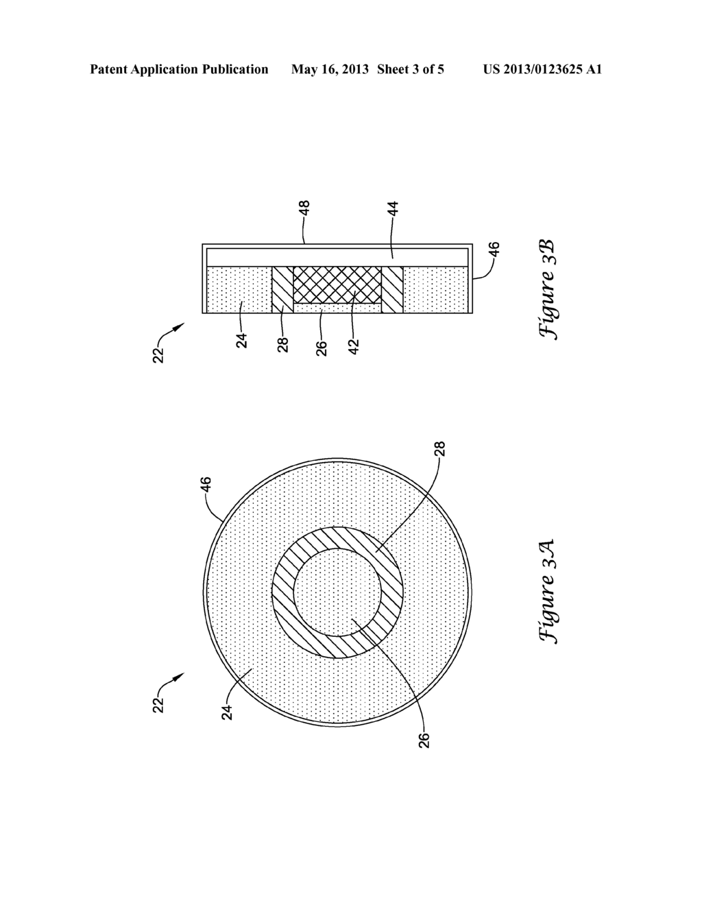 INTEGRATED ULTRASOUND ABLATION AND IMAGING DEVICE AND RELATED METHODS - diagram, schematic, and image 04