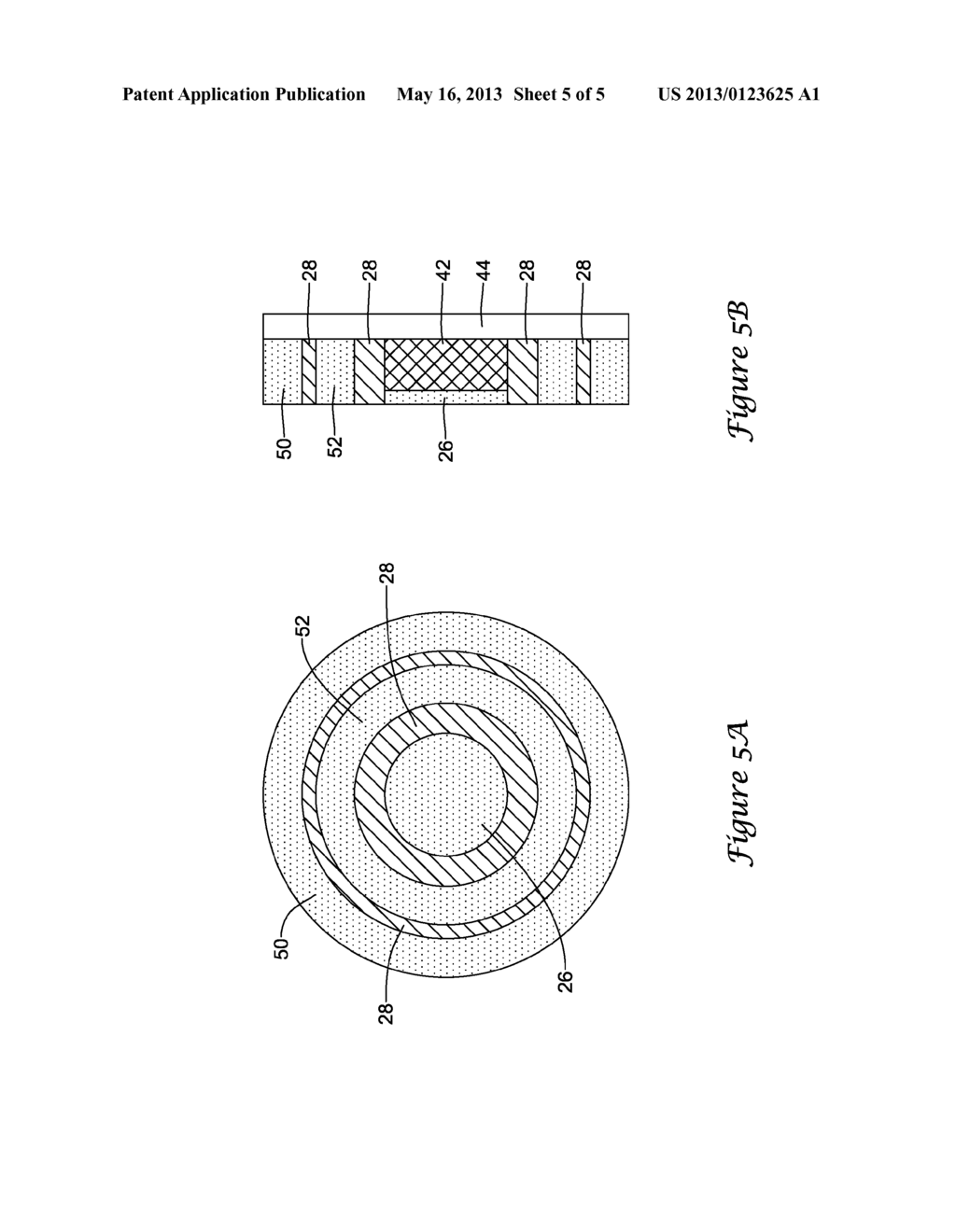 INTEGRATED ULTRASOUND ABLATION AND IMAGING DEVICE AND RELATED METHODS - diagram, schematic, and image 06