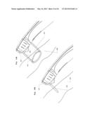 Scanned Laser Vein Contrast Enhancer diagram and image