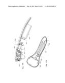 Scanned Laser Vein Contrast Enhancer diagram and image