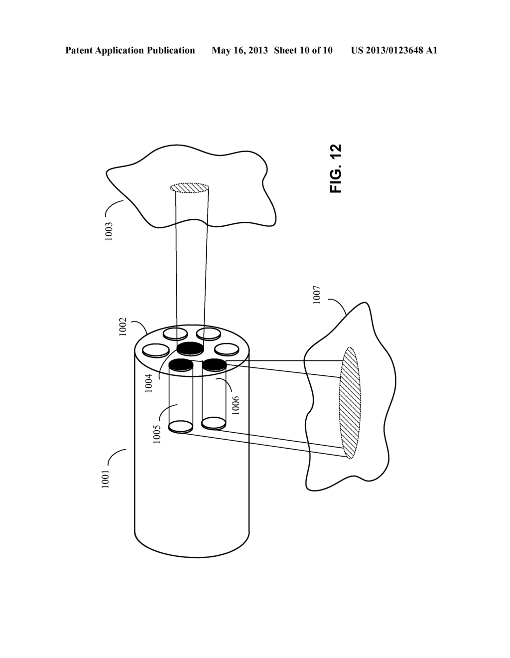 MEDICAL DIAGNOSIS AND TREATMENT USING MULTI-CORE OPTICAL FIBERS - diagram, schematic, and image 11