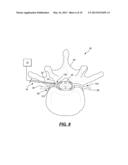 METHOD OF ASSESSING NEURAL FUNCTION diagram and image