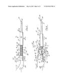 Injection Molded Adjustable Shape Abscess Irrigation Device diagram and image