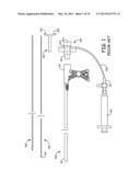 CATHETER APPARATUS diagram and image