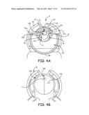 CATHETER APPARATUS diagram and image