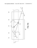 CATHETER APPARATUS diagram and image