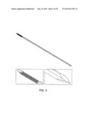 OSTEOSYNTHETIC SHAPE MEMORY MATERIAL INTRAMEDULLARY BONE STENT AND METHOD     FOR TREATING A BONE FRACTURE USING THE SAME diagram and image