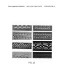 OSTEOSYNTHETIC SHAPE MEMORY MATERIAL INTRAMEDULLARY BONE STENT AND METHOD     FOR TREATING A BONE FRACTURE USING THE SAME diagram and image