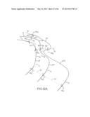 SYSTEM AND METHOD FOR MANUFACTURING ARTHROPLASTY JIGS HAVING IMPROVED     MATING ACCURACY diagram and image