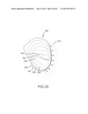 SYSTEM AND METHOD FOR MANUFACTURING ARTHROPLASTY JIGS HAVING IMPROVED     MATING ACCURACY diagram and image