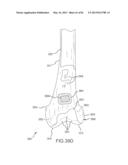 SYSTEM AND METHOD FOR MANUFACTURING ARTHROPLASTY JIGS HAVING IMPROVED     MATING ACCURACY diagram and image