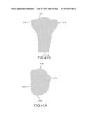 SYSTEM AND METHOD FOR MANUFACTURING ARTHROPLASTY JIGS HAVING IMPROVED     MATING ACCURACY diagram and image