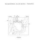 SYSTEM AND METHOD FOR MANUFACTURING ARTHROPLASTY JIGS HAVING IMPROVED     MATING ACCURACY diagram and image