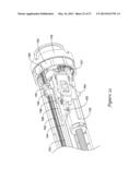 BOND BETWEEN COMPONENTS OF A MEDICAL DEVICE diagram and image