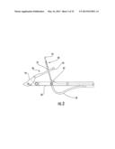 MEDICAL DEVICE FIXATION TOOL AND METHOD OF FIXATION OF A MEDICAL DEVICE diagram and image