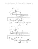 MEDICAL DEVICE FIXATION TOOL AND METHOD OF FIXATION OF A MEDICAL DEVICE diagram and image