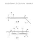 MEDICAL DEVICE FIXATION TOOL AND METHOD OF FIXATION OF A MEDICAL DEVICE diagram and image