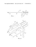 Soft Tissue Repair Device and Associated Methods diagram and image