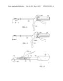 Soft Tissue Repair Device and Associated Methods diagram and image