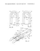 Soft Tissue Repair Device and Associated Methods diagram and image