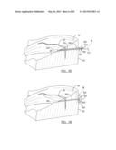 Soft Tissue Repair Device and Associated Methods diagram and image