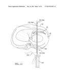 Soft Tissue Repair Device and Associated Methods diagram and image