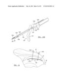 Soft Tissue Repair Device and Associated Methods diagram and image