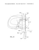 Soft Tissue Repair Device and Associated Methods diagram and image